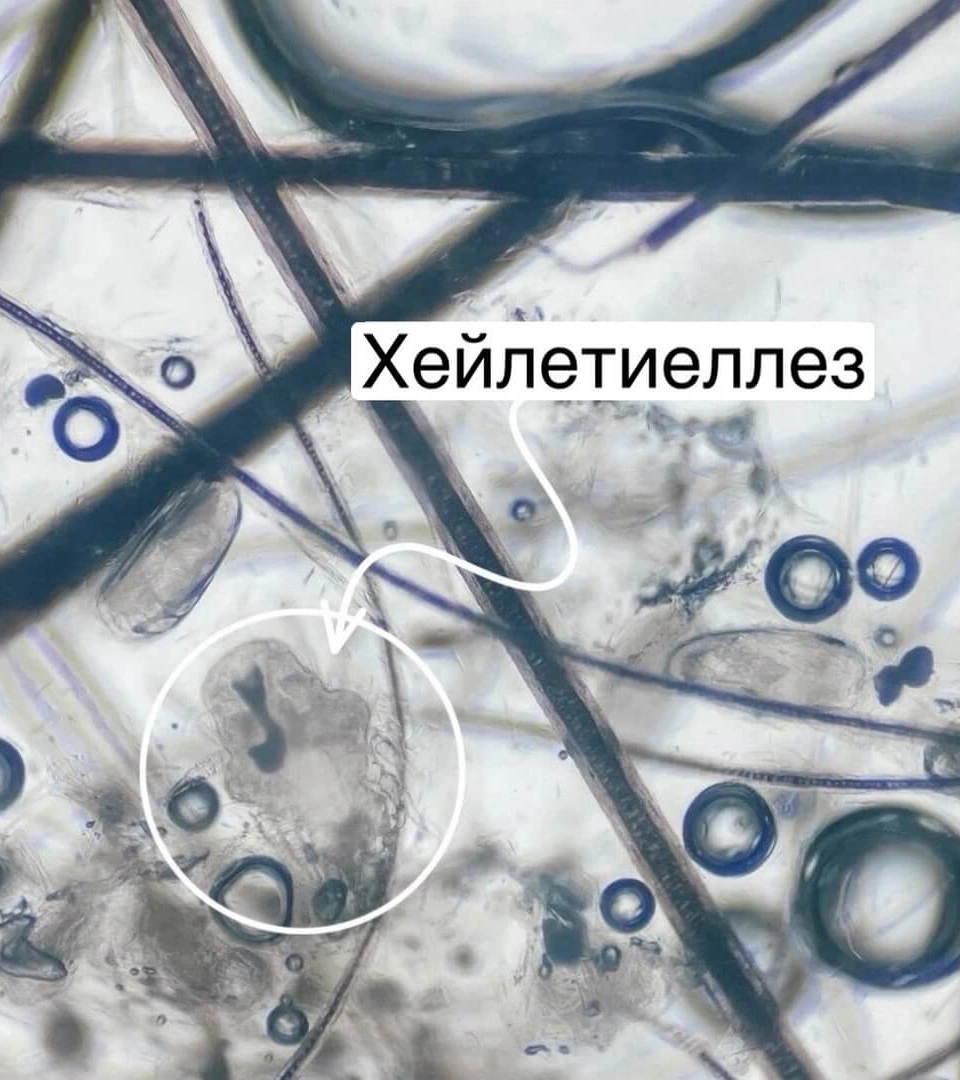 Хейлетиеллез фото 3