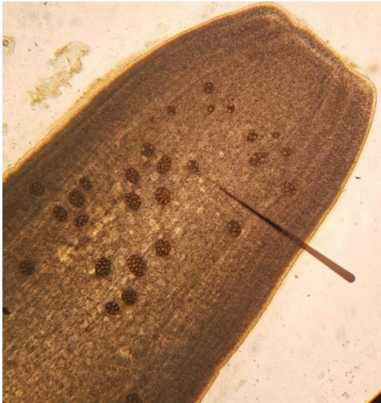 Dipylidium caninum с «пакетами» яиц. Увеличение х40.