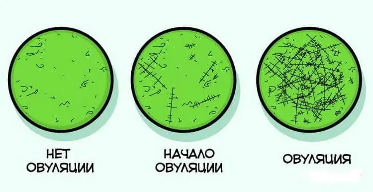 метод кристаллизации слюны